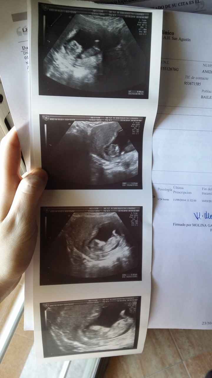 El consultorio de Lita para futuras mamis - 2