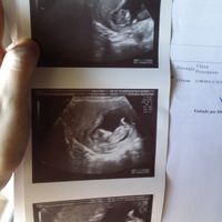 El consultorio de Lita para futuras mamis - 2