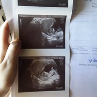 El consultorio de Lita para futuras mamis - 2