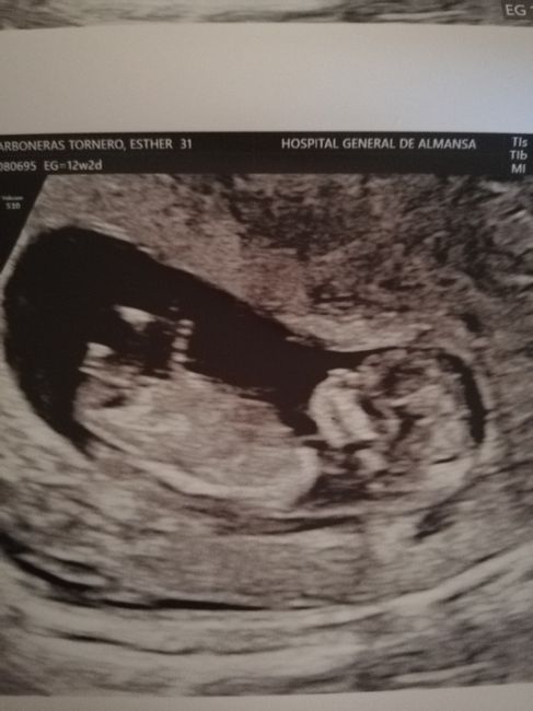 Futuras mamas octubre 2020 - 1