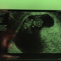 Futuras mamas febrero 2017 - 1