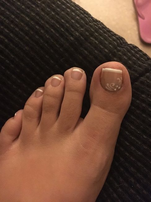 Uñas de los pies - 1