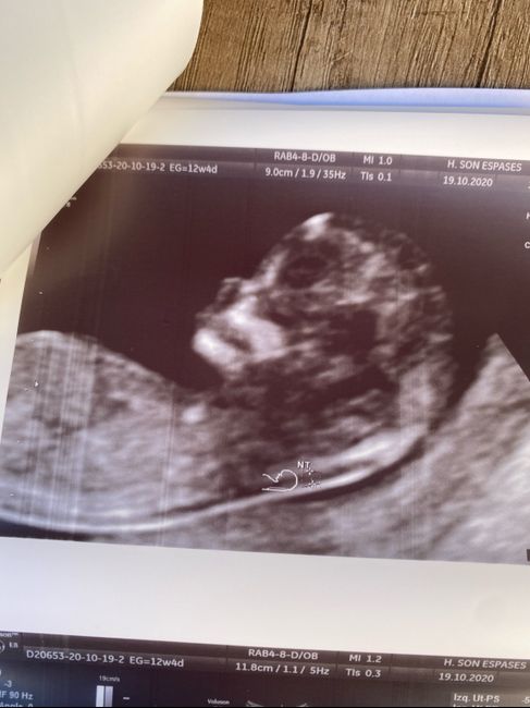 Futuras mamás Mayo 2021🤰♥️ - 1