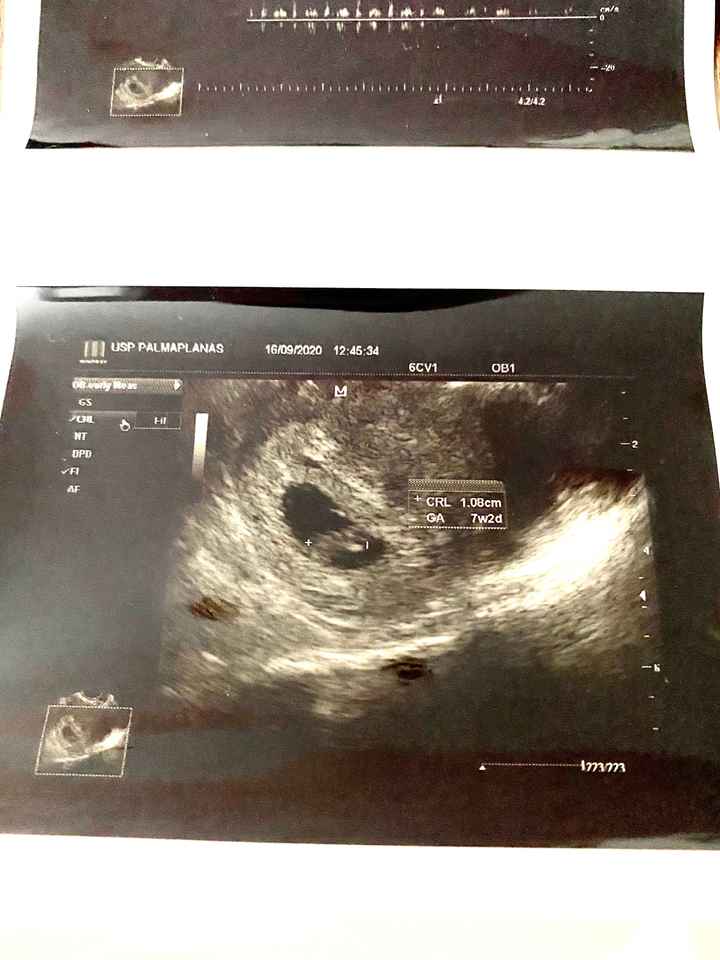 Futuras mamás Mayo 2021🤰♥️ - 2