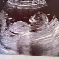 Futuras mamás Mayo 2021🤰♥️ - 2