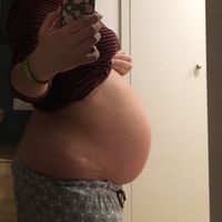 Tripa 37 semanas