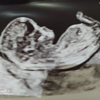 Futuras mamas noviembre 2020 - 1