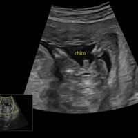 Futuras mamas noviembre 2020 - 1