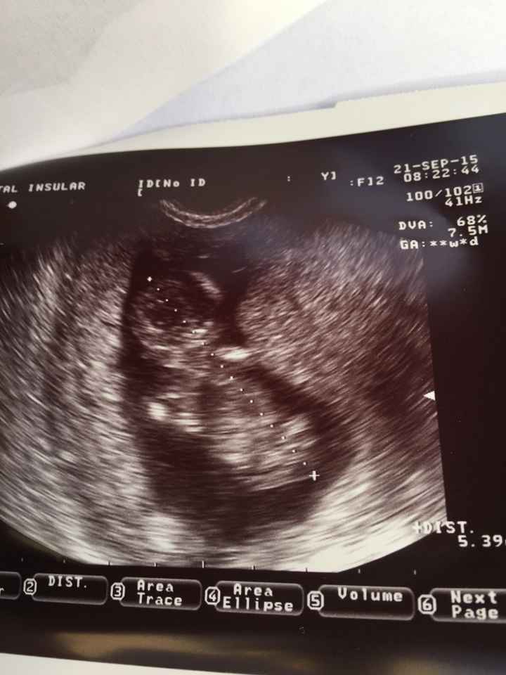 Mamis abril 2016 - 1
