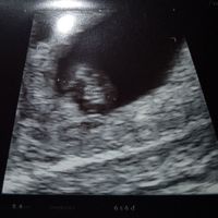 Futuras mamás enero 2019 - 1