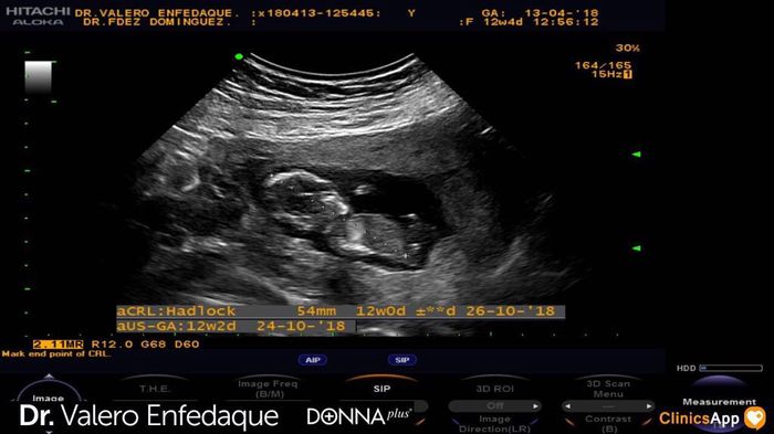 Futuras mamás Octubre 2018!!! - 1