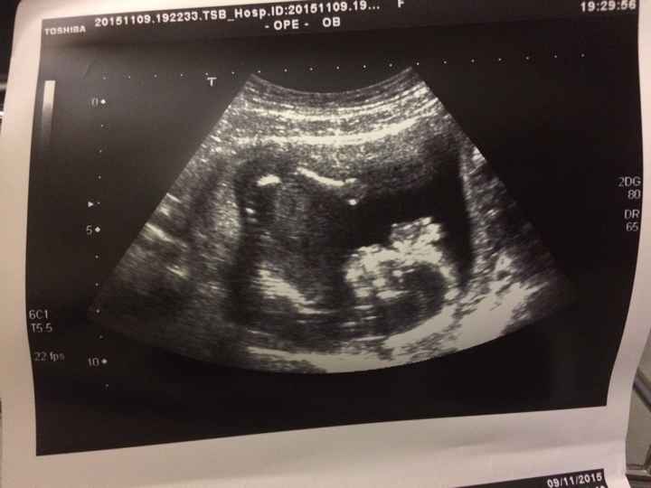 Mamis abril 2016 - 1