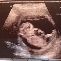 El consultorio de Lita para futuras mamis - 1