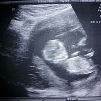 El consultorio de Lita para futuras mamis - 2