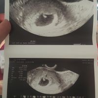 Futuras mamis Marzo 2021 ❤️❤️ - 1