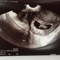 Futuras mamis Marzo 2021 ❤️❤️ - 1