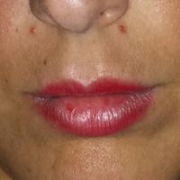  Asustada con la limpieza facial - 1