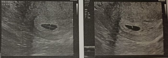 Futuras mamas octubre 2020 - 1