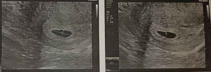 Futuras mamas octubre 2020 - 1