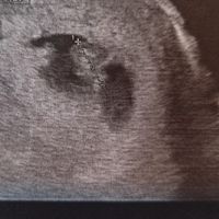 Futuras mamas octubre 2020 - 1