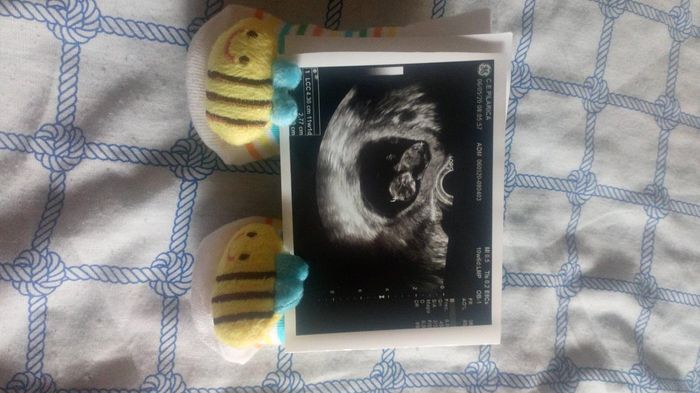 Futuras mamas noviembre 2020 - 2