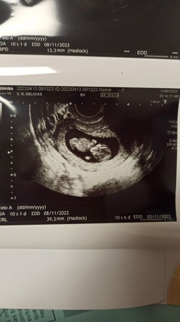 Futuras mamis noviembre 2022 - 1