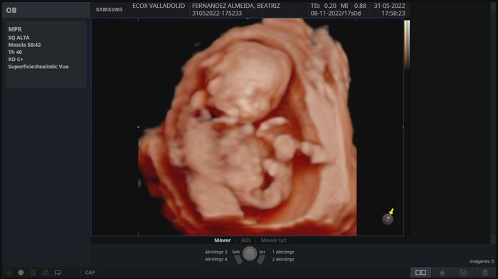 Futuras mamis noviembre 2022 3