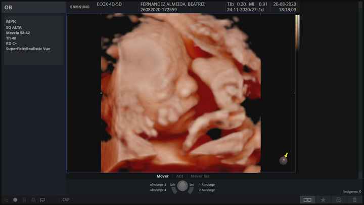 Futuras mamas noviembre 2020 - 2
