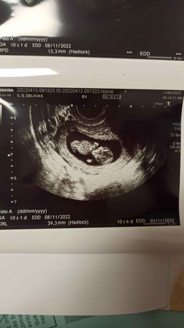 Futuras mamis noviembre 2022 - 1