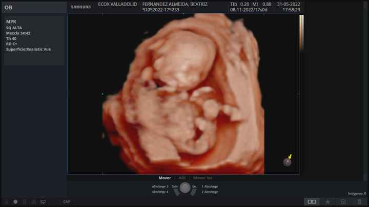 Futuras mamis noviembre 2022 - 1
