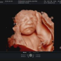 Futuras mamas noviembre 2020 - 1