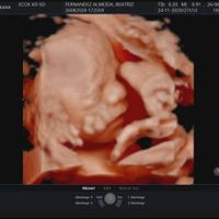 Futuras mamas noviembre 2020 - 2