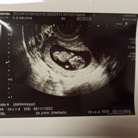 Futuras mamis noviembre 2022 - 1