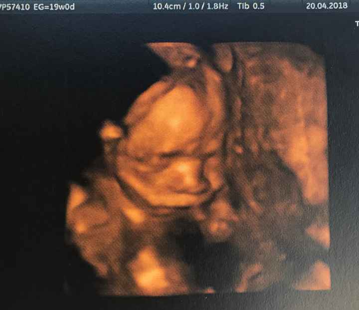 Nuevo! Futuras mamas Septiembre 2018 - 1