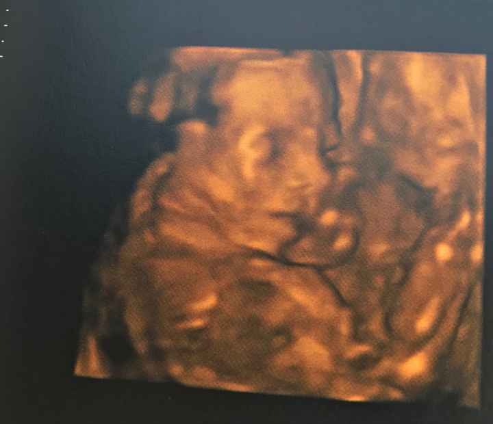 Nuevo! Futuras mamas Septiembre 2018 - 2