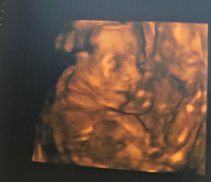 Nuevo! Futuras mamas Septiembre 2018 - 2