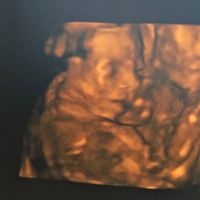 Nuevo! Futuras mamas Septiembre 2018 - 2