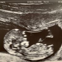 Futuras Mamis Abril 2021 - 1