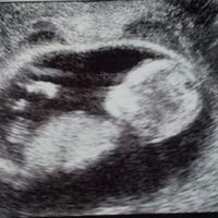 mi bebe 12 5