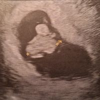 Niño o niña - 1