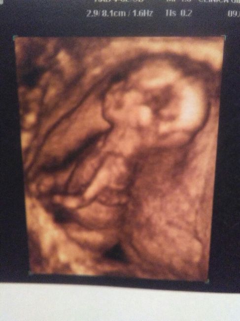 ¡futuras mamis noviembre 2016! - 2