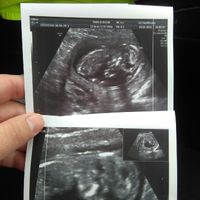 ¡futuras mamis noviembre 2016! - 1