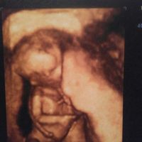 ¡futuras mamis noviembre 2016! - 1