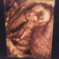 ¡futuras mamis noviembre 2016! - 2