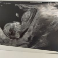 Futuras mamas septiembre 2021🤰🤱 - 1