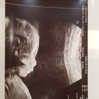 Futuras mamás marzo 2019 - 2