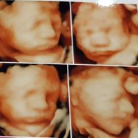 Futuras mamás marzo 2019 - 2