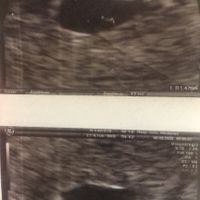 Futuras Mamis Enero 2021 - 1