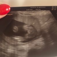 Futuras Mamis Enero 2021 - 1