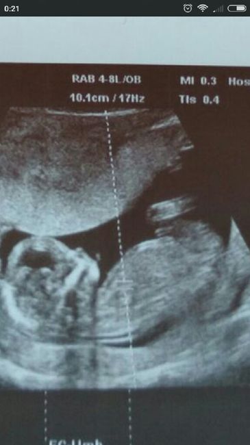 Niño o niña?? Ayudadme expertas🔮 - 1